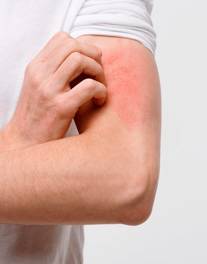 Dermatologia Clínica